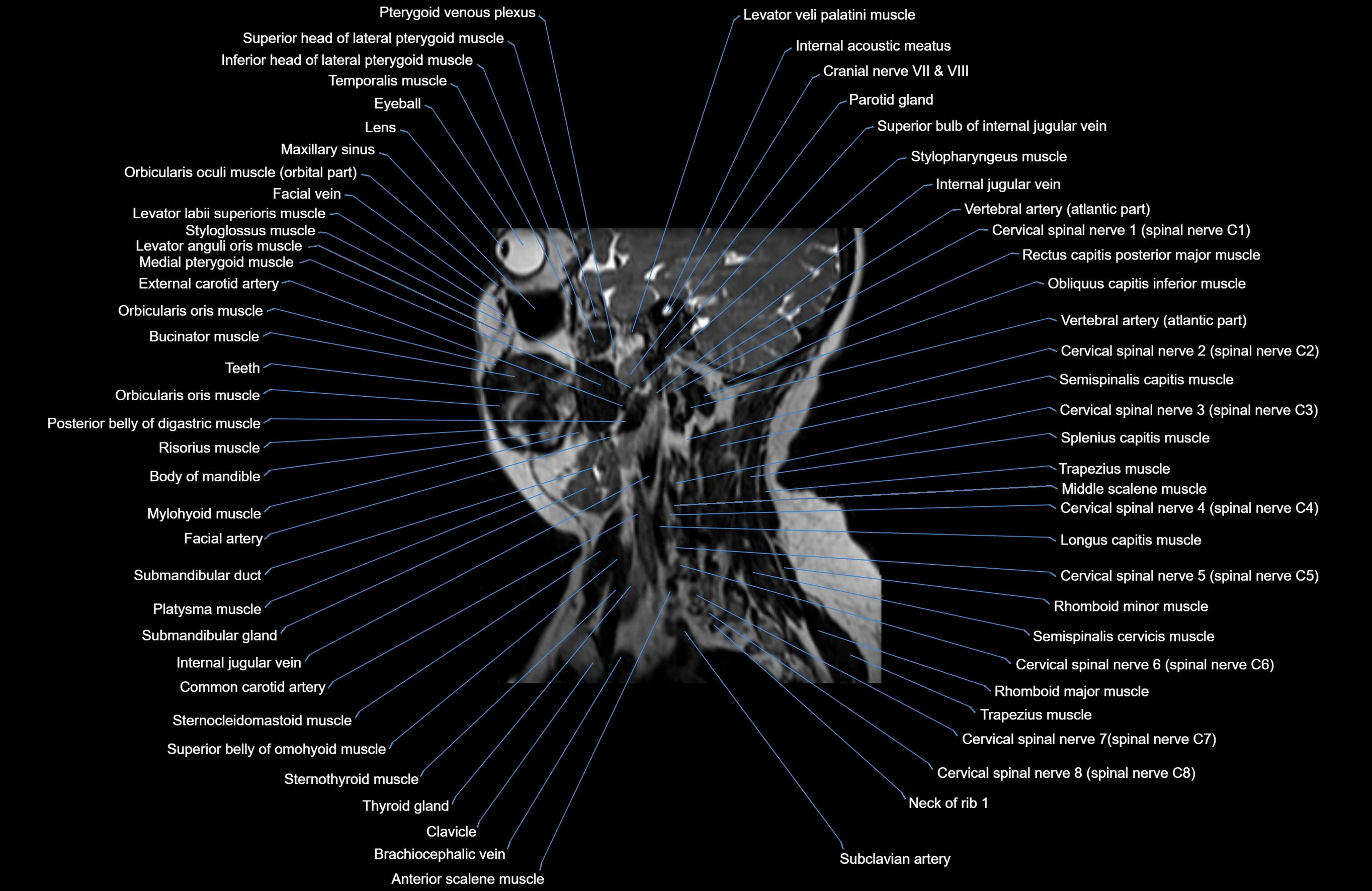 Neck MRI sagittal cross sectional anatomy 3D 1mm 3T radiology  image-img-00001-00020.webp